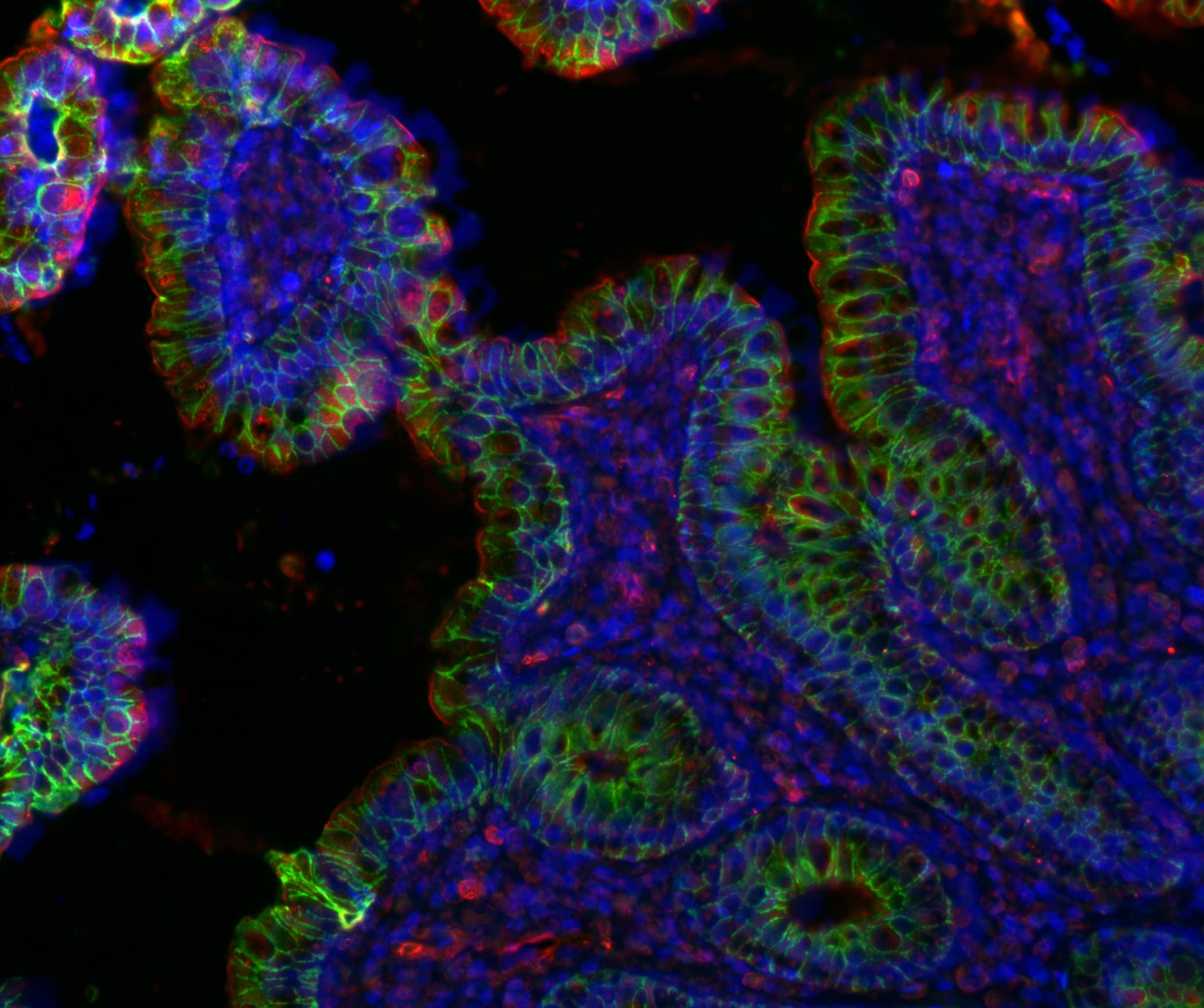 fluorescent micrograph